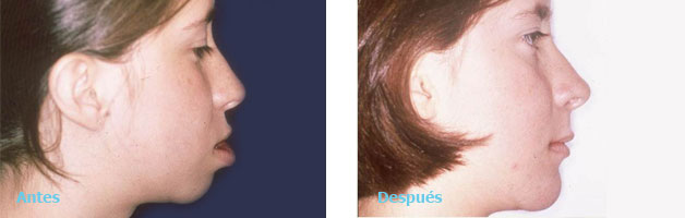 Cirugia Maxilofacial y Deformidades dentofaciales