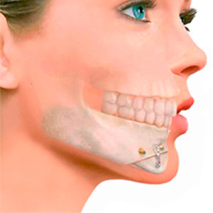 Cirugia Maxilofacial que es