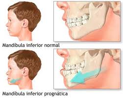 Cirugia Maxilofacial