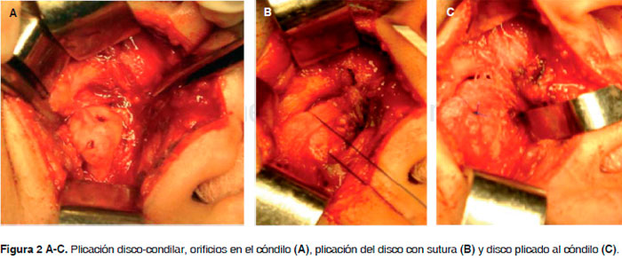 Figura 2