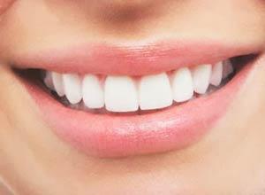 Sonrisa