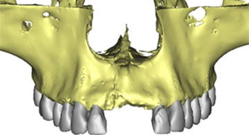 Software Dental 3D