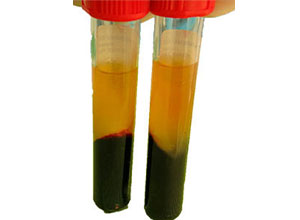 Plasma rico en fibrina