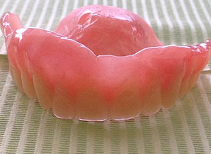 Rehabilitación Protesica con Enfermedad Periodontal