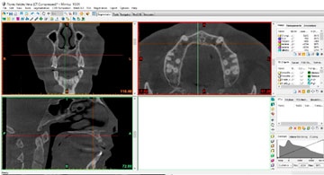 Software Dental 3D