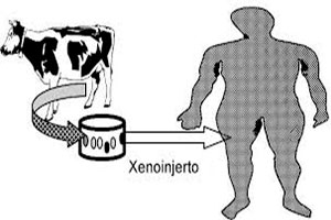 Xenoinjerto