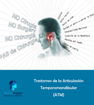Trastornos de la Articulación Temporomandibular