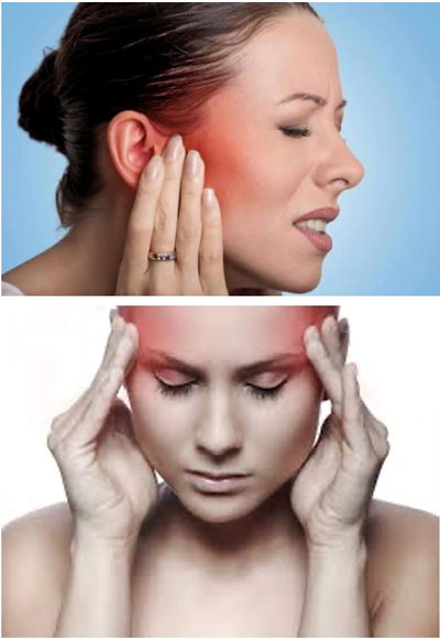 Dolor Facial Idiopático