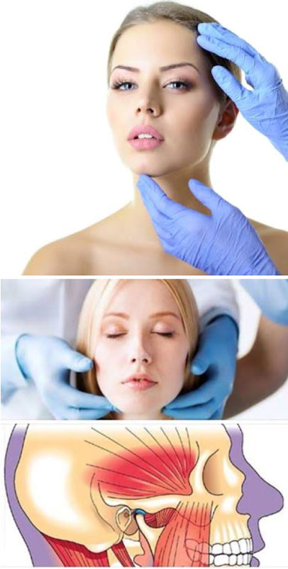 Dolor Facial Idiopático