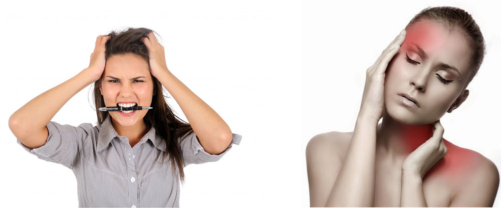Dolor Facial Idiopático