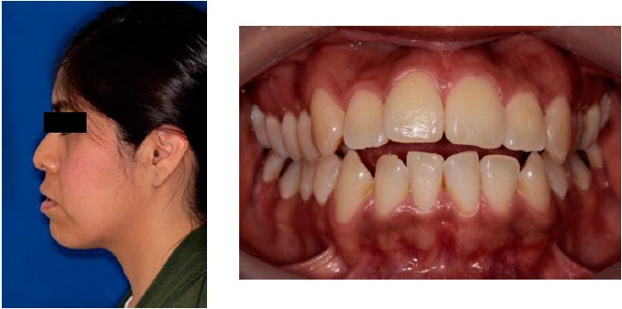 Tratamiento ortodóncico y ortopédico