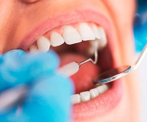 Recomendaciones en ortodoncia