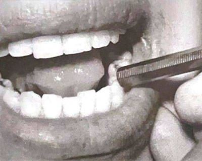 La boca y la medicina - Historia Clínica