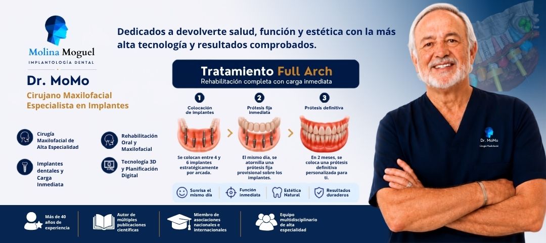 Tratamiento Full Arch